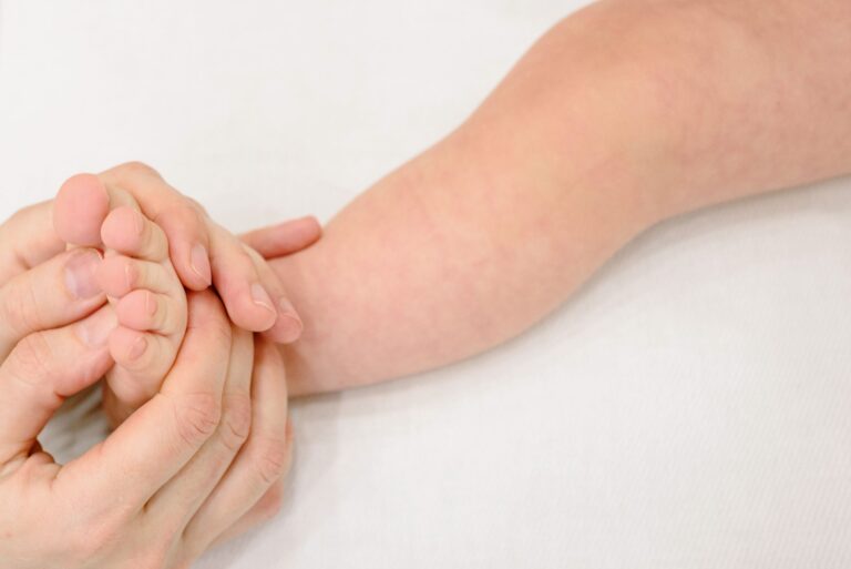 Alergias cutáneas: Sarpullido bebé cuerpo y causas en la cara
