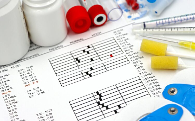  Alfa 2 globulina alta: causas y diagnóstico en proteinograma