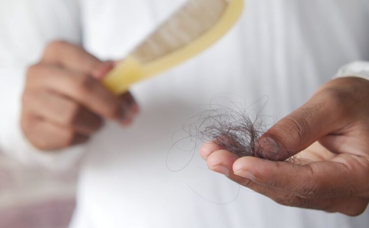  Alopecia fibrosante frontal: causas, síntomas y tratamientos efectivos