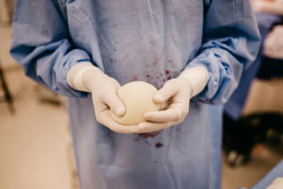  Cirujano quiste pilonidal: qué es un sinus y fístula en el coxis