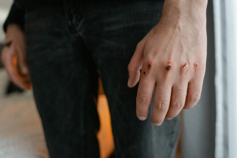 Cortada dedo: Cómo curar y tratar heridas profundas eficazmente