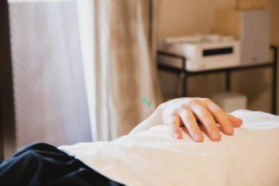  Descanso tras punción seca: guía para una recuperación efectiva