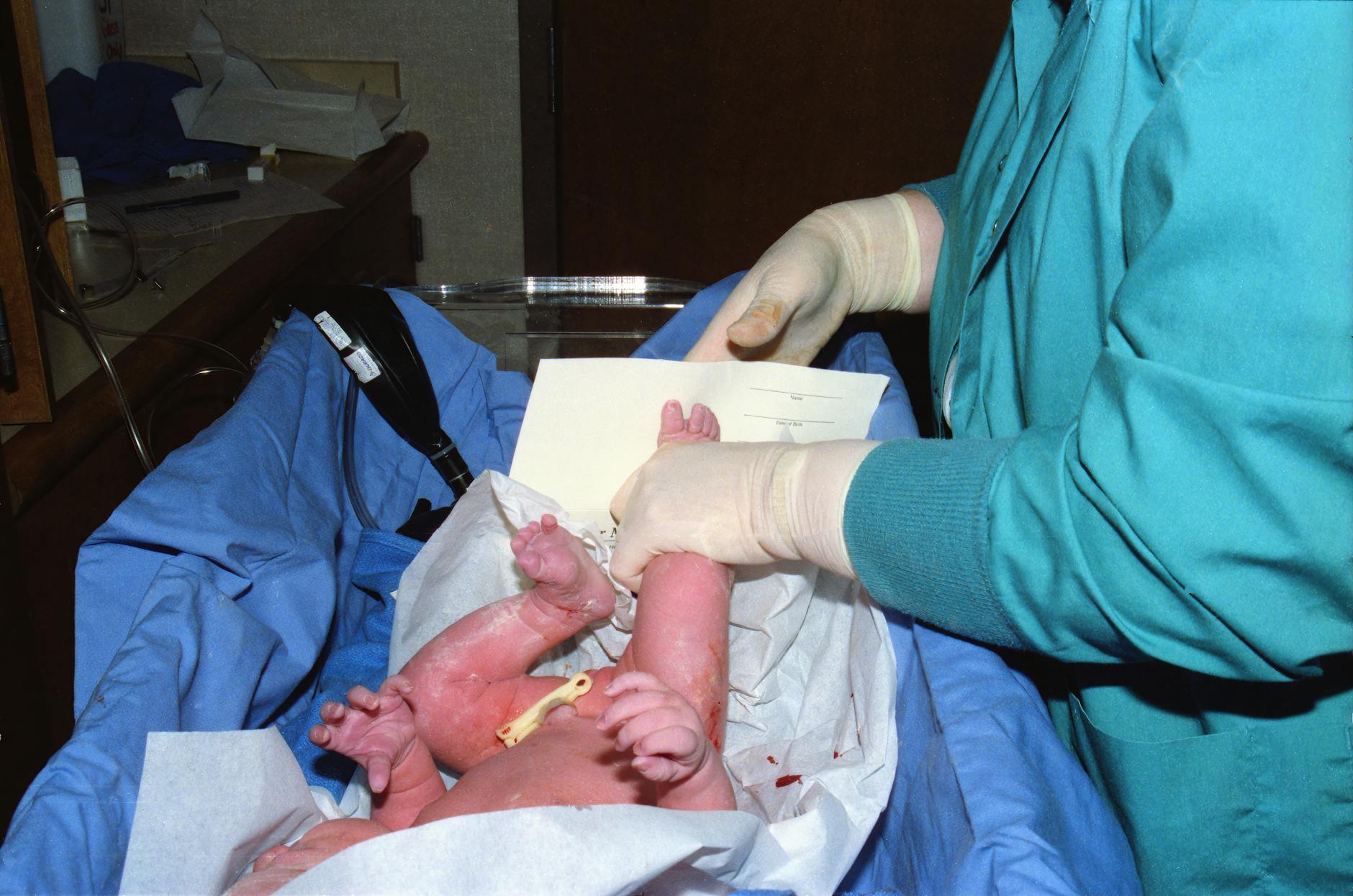 donar cordon umbilical proceso y beneficios esenciales