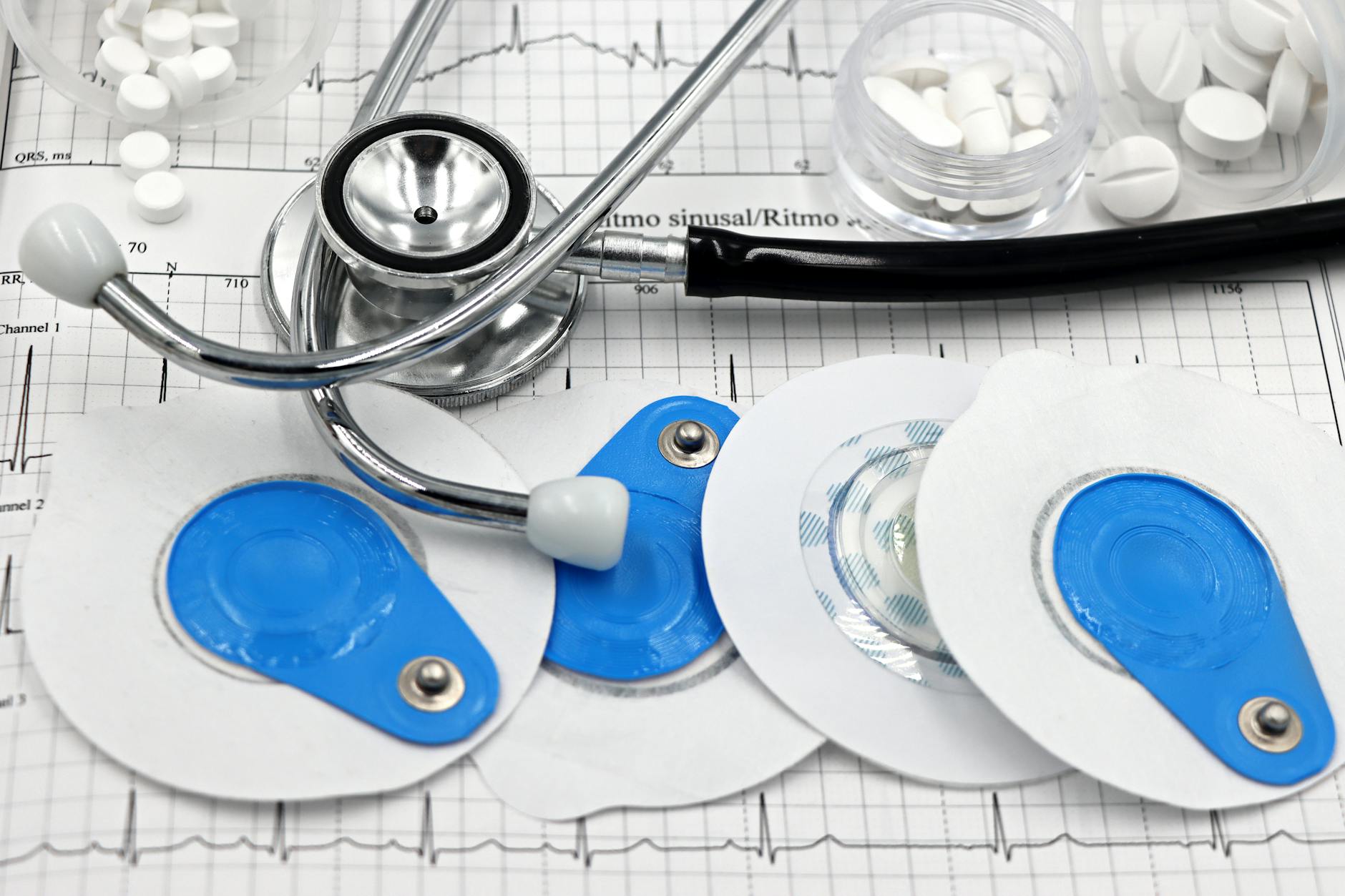 flutter arritmia digestiva y sus complicaciones cardiacas