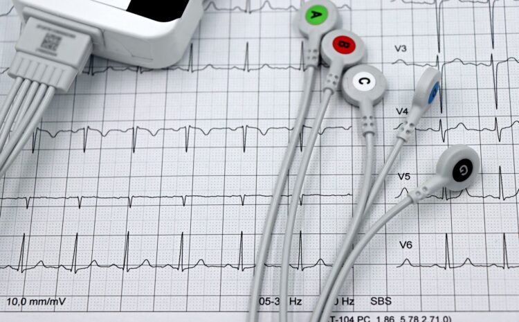  Holter tensión: ¿Qué es y cómo se realiza este estudio?