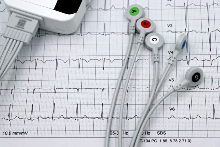 Holter tensión: ¿Qué es y cómo se realiza este estudio?