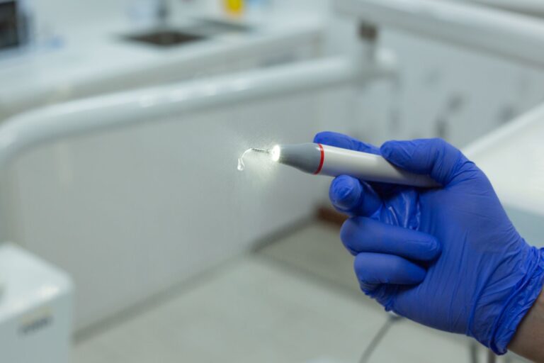Limpieza dental: Todo sobre tartrectomía y su importancia