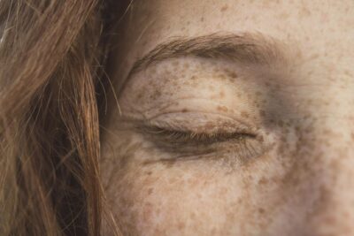  Operación párpado caído: todo sobre la blefaroplastia