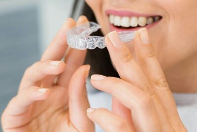  Tipo de brackets: Opciones estéticas para adultos discretos